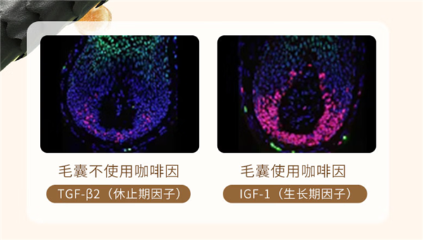 强韧发根 减缓脱发！欧倍青C1洗发水发车：立减16元