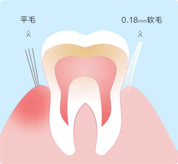 半价狂促：纳爱斯SPA级软毛牙刷16支19.8元速囤