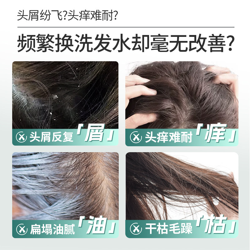 【会员享加赠】舒蕾氧活洗发水控油清凉蓬松去屑夏天去屑止痒去油
