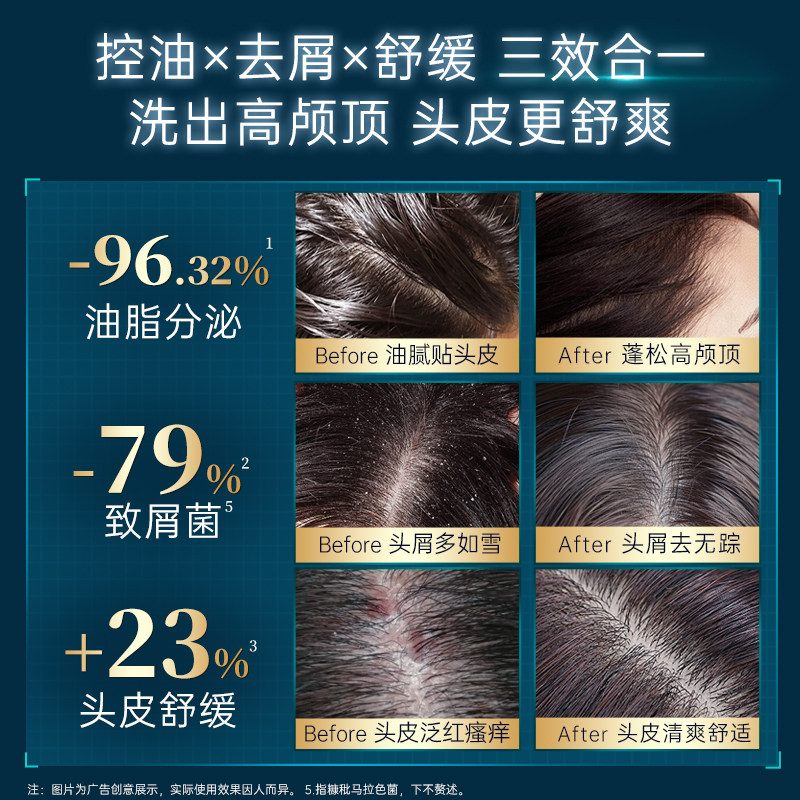 卡蓓诺去屑洗发水控油蓬松止痒舒缓头皮去头屑洗发露液无二硫化硒