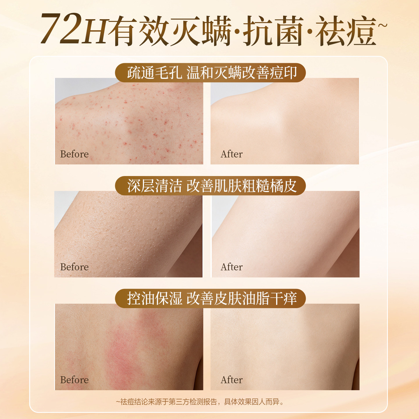纳爱斯硫磺液体香皂净痘除螨清爽控油止痒洗脸洗发男女官方