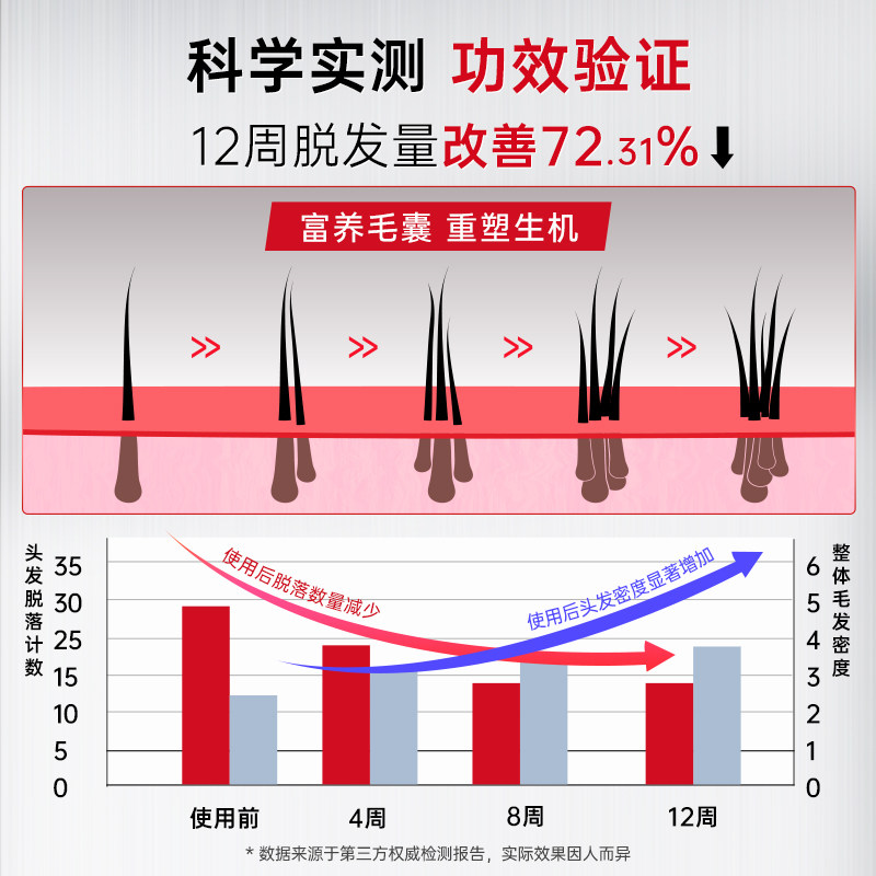 卡蓓诺防脱洗发水固发密发护发蓬松控油精华防脱发洗发露液进口